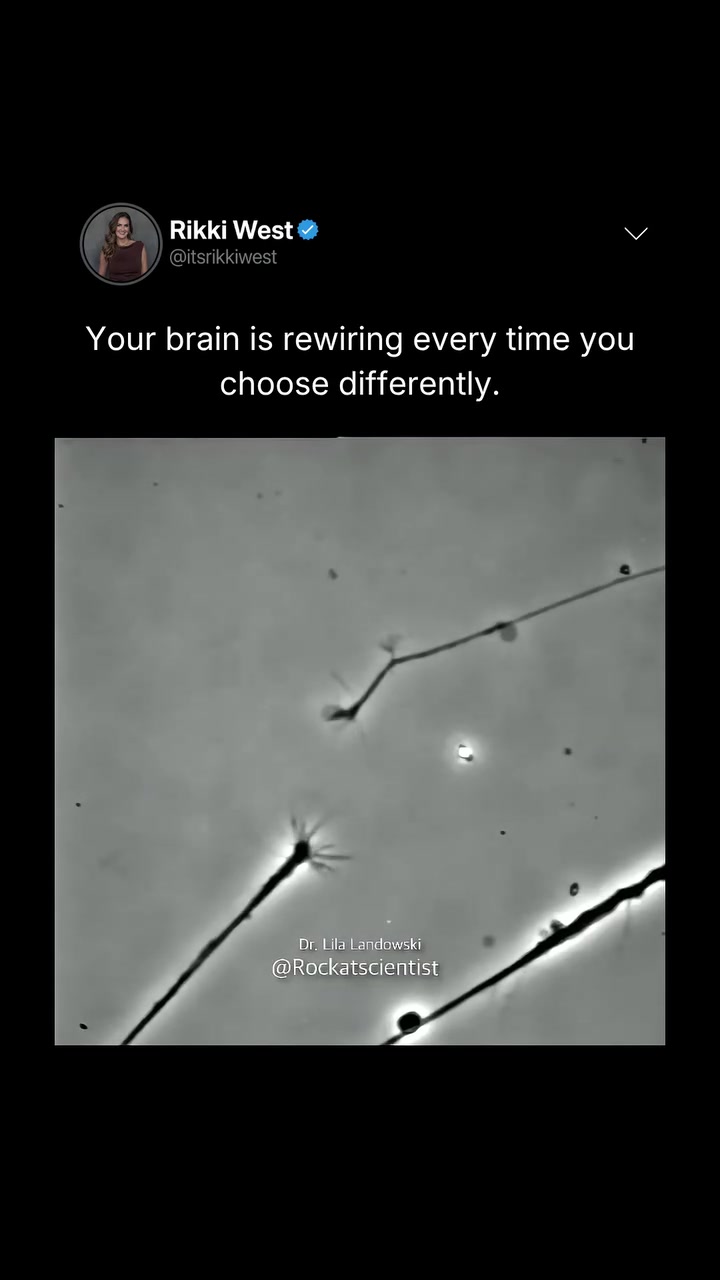 See Neurons Connect: A Glimpse of Brain Rewiring