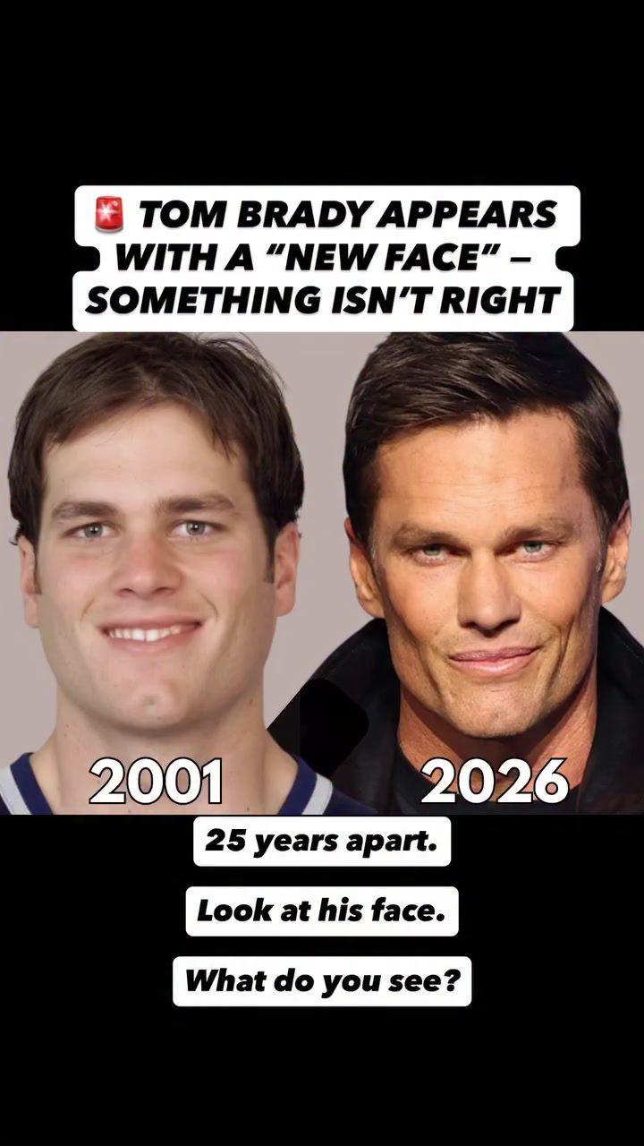 Tom Brady's Drastic Face Change: 2001 to 2026