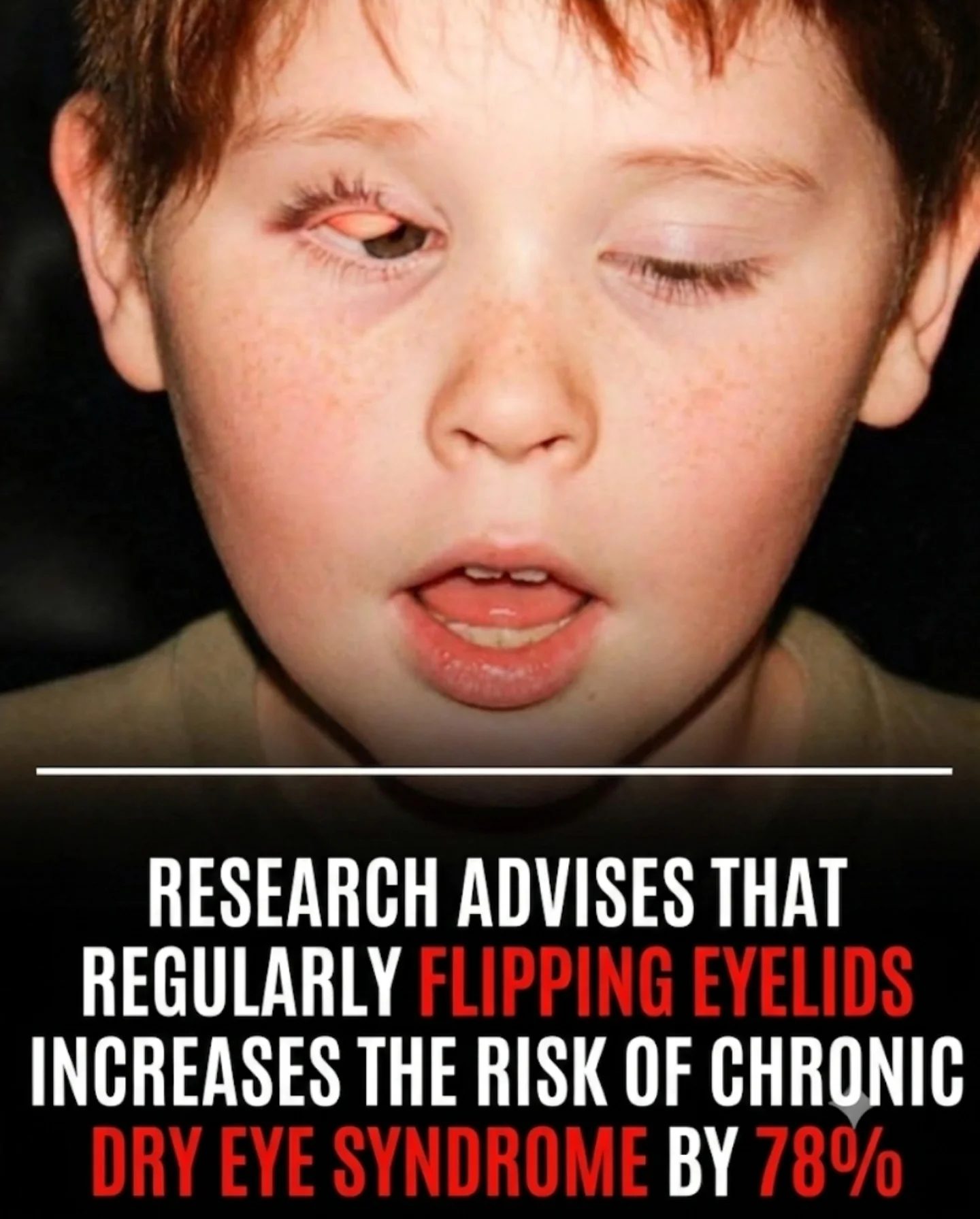 Eyelid Flipping: Debunking Myths and Real Eye Health Risks
