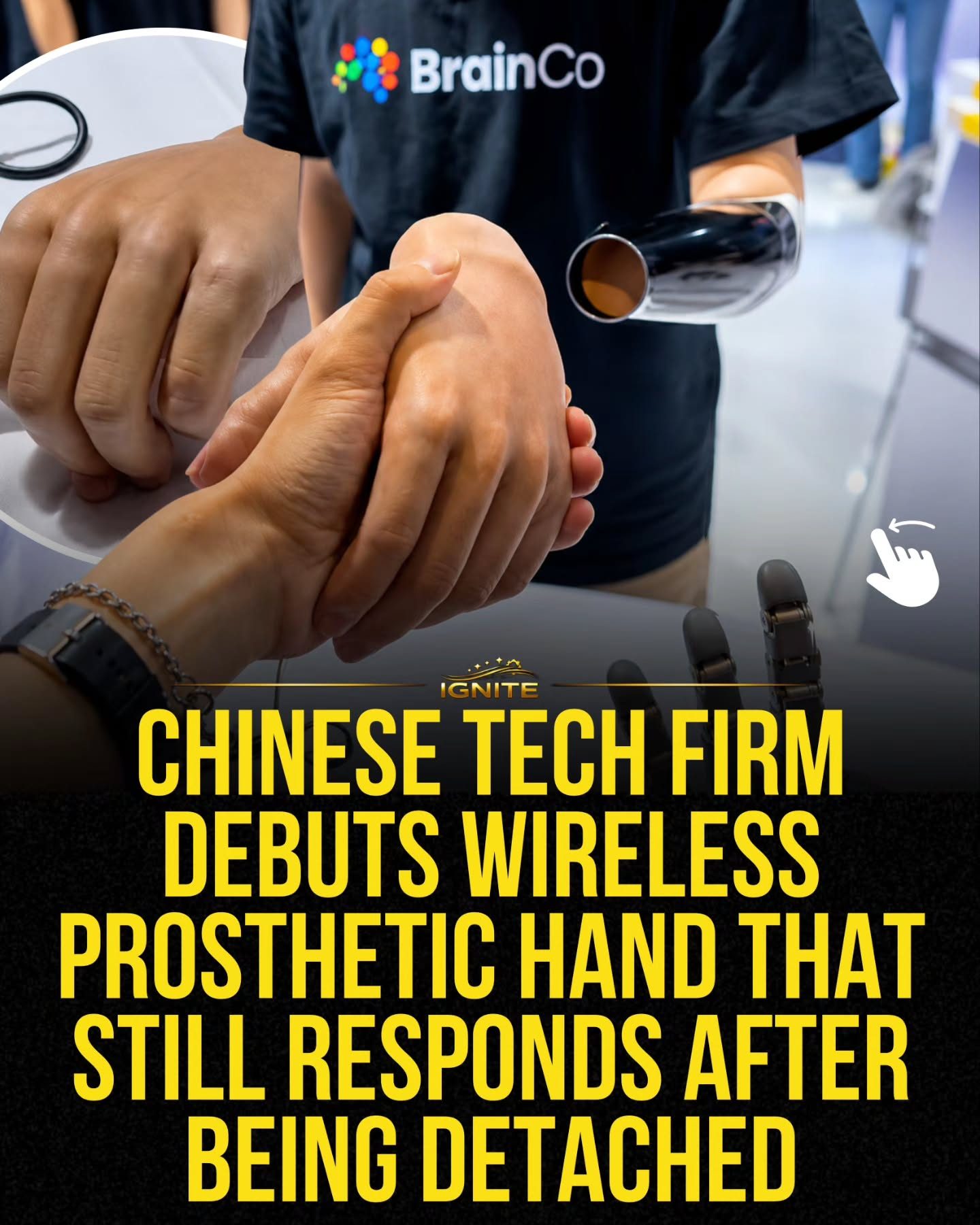 BrainCo's Wireless Prosthetic Hand: Revolutionary Tech