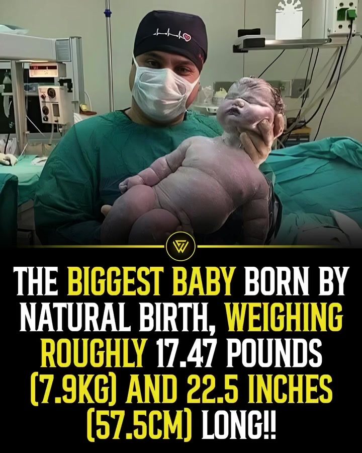 The Heaviest Baby Born Naturally: A Medical Marvel