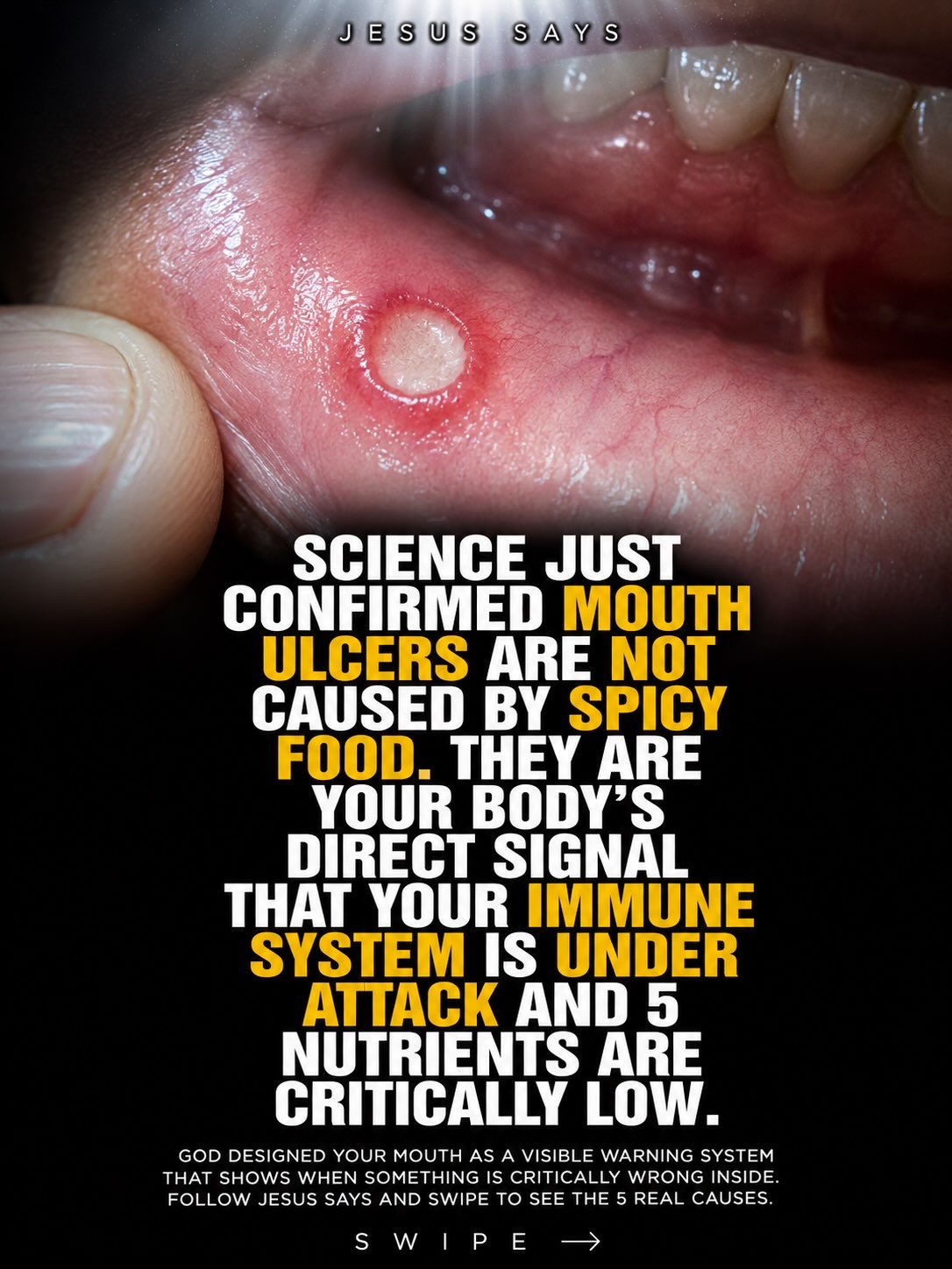 The Truth About Mouth Ulcers: Causes and Natural Remedies