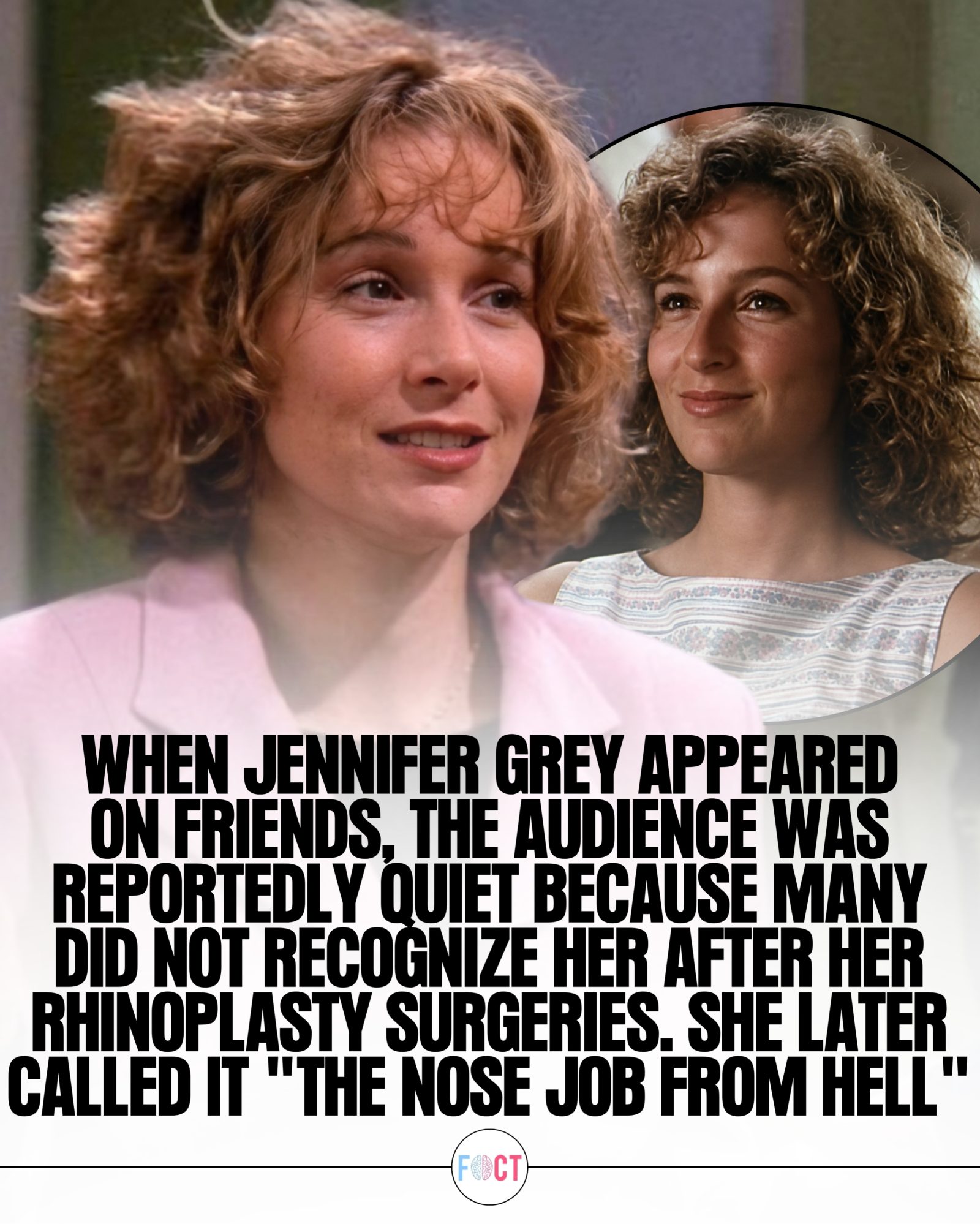 Jennifer Grey's Dramatic Change: From Dirty Dancing to Friends